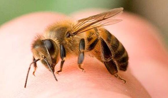 蜜蜂蜇伤 - 扩大阴茎的一种极端方式
